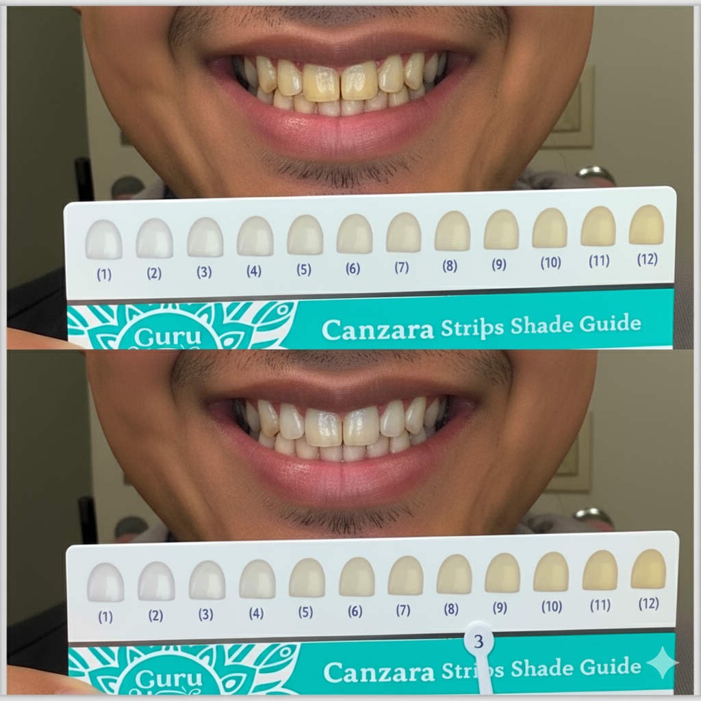 Canzara™ Teeth Whitening Strips