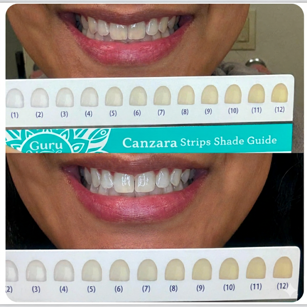 Canzara™ Teeth Whitening Strips