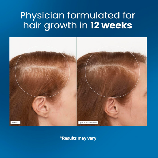 Canzara™ Ultimate Hair Serum Kit