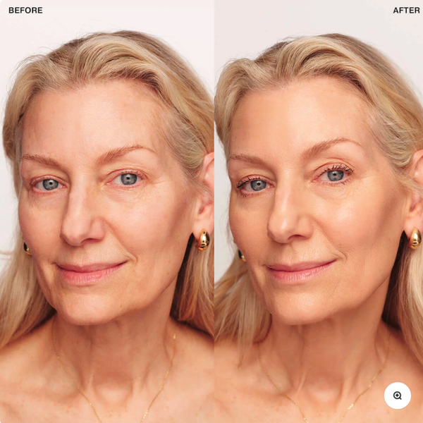 See Yourself Again: The 4-in-1 Foundation That Erases Wrinkles & Dark Spots While You Wear It